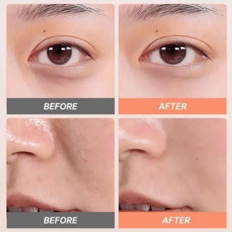 TOUCHBeauty Lift2 Beauty Device - Multi-Dimensional Anti-Aging Technology