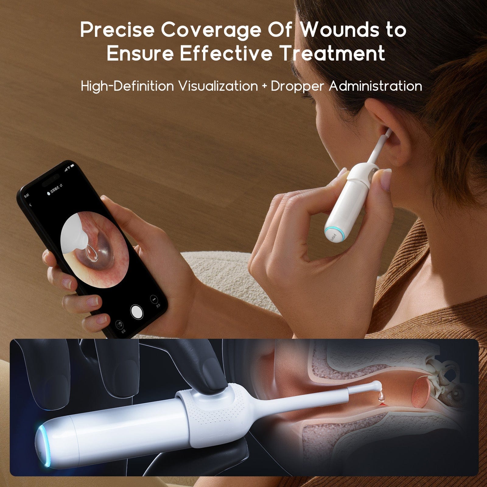 Bebird Home 30S Home Edition Ear Wax Removal Cleaner with Tweezer | Ear Cleaning Otoscope