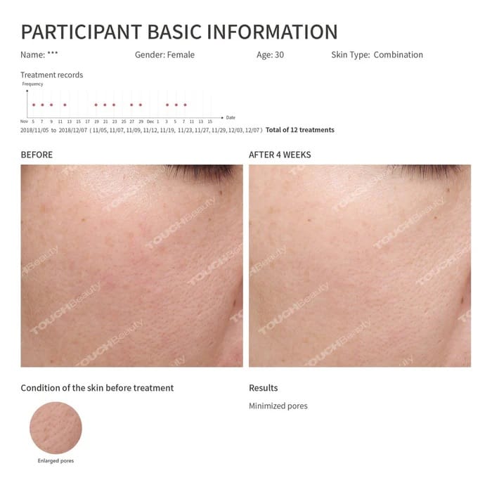 TOUCHBeauty Hot & Cool Skin Device - Advanced Facial & Eye Rejuvenation